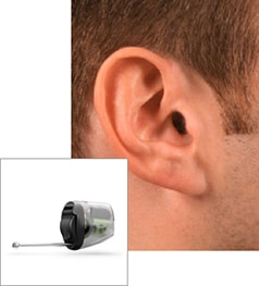 Invisible-in-the-Canal (IIC) Hearing Aids